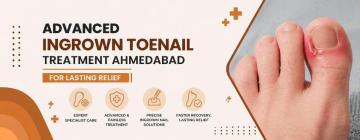 Best Ingrown Toenail Treatment in Ahmedabad – Savannah Aesthetics