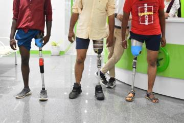 Best Prosthetic Leg Clinic in Hyderabad | CareVale Prosthetics