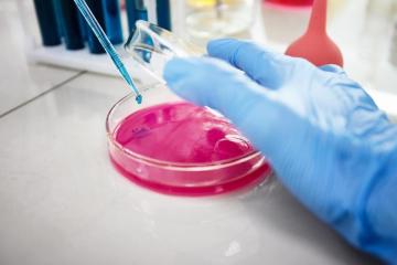 Understand Protein Profiles Through Western Blot Gel Electrophoresis