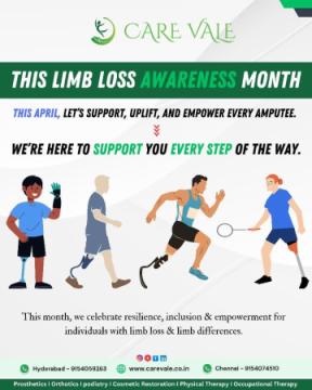 Best Artificial Leg in Hyderabad | CareVale Prosthetics