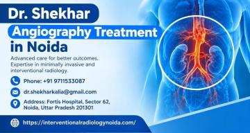 Angiography Treatment in Noida