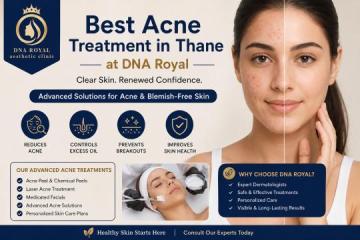 Skin Care for Persistent Acne and Breakouts at DNA Royal Aesthetic Clinic