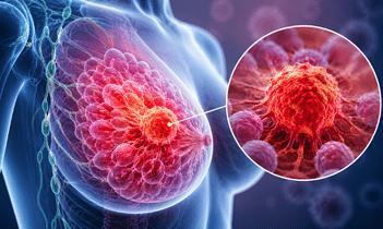 Advanced Breast Oncologist in Dehradun for Treatment
