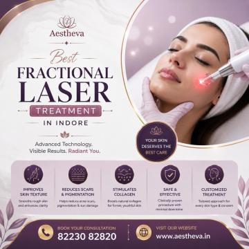 Fractional Laser Treatment in Indore - Aestheva