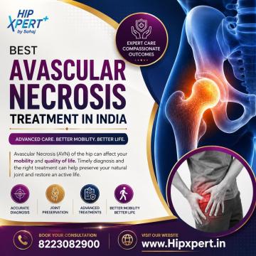 Best Avascular Necrosis Treatment in India - Hip Xpert