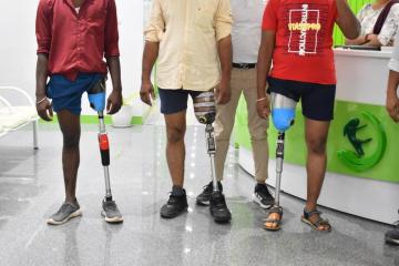 Best Prosthetic Leg Clinic in Hyderabad | CareVale Prosthetics