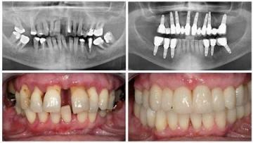 Align Dental Care