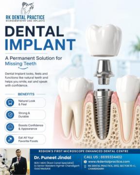 Dental Implant Clinic in Chandigarh for Smiles