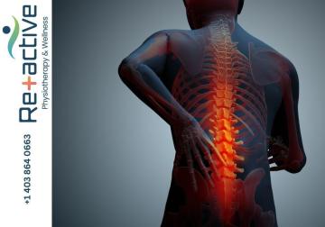 Best Physiotherapy Sylvan Lake | Reactive Physical Therapy AB