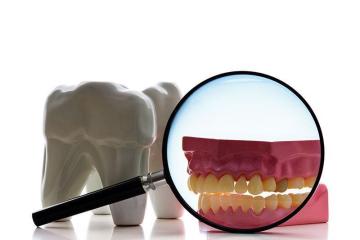 dental crowns chino hills