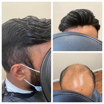 Buy Toupee for Men – Natural Looking Hair Replacement