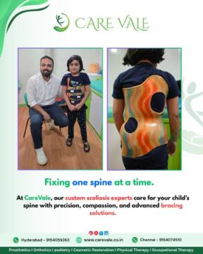 Free Artificial leg In Hyderabad | CareVale Prosthetics