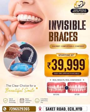Wondering About Invisalign Cost in Hyderabad? Here's Your Answer.