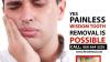Wisdom Tooth Removal in Secunderabad – FMS Dental Clinics