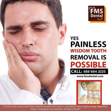 Wisdom Tooth Removal in Secunderabad – FMS Dental Clinics