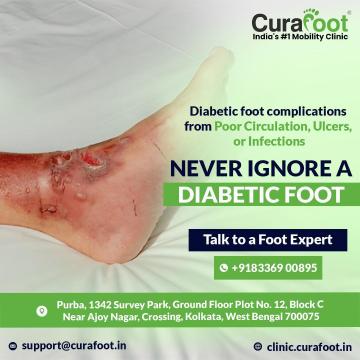 Effective Diabetic Foot Ulcer Treatment in Kolkata