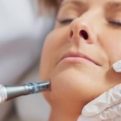 Skin Laxity Treatment Fort Collins Firm Tighten Skin