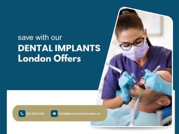 Save with Our Dental Implants London Offers