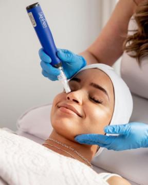 Microneedling in Colorado Springs