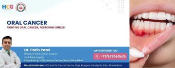 Oral Cancer Treatment Specialist – Ahmedabad Location