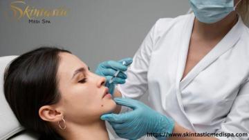 Enhance Your Look with Premium Fillers Riverside