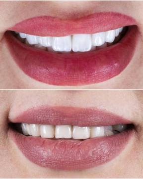 Zahnaerztin Muenchen Dr. Sabrina von Rakowski | Endodontie, Implantate, Zahnersatz |