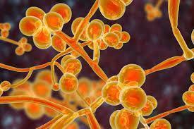 PCR Reagent Manufacturer – Custom Assays & Measles Detection