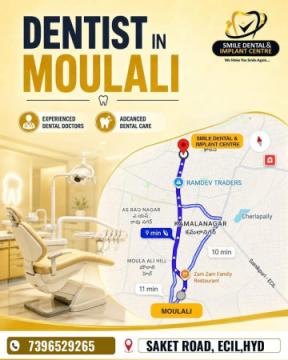 Top-Rated Dental Clinic near Moulali & ECIL – Advanced & Painless Treatments