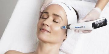 Best Microneedling Service in Surrey – Book Now!