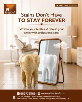 Professional Teeth Cleaning in Indirapuram for Healthy Teeth and Gums