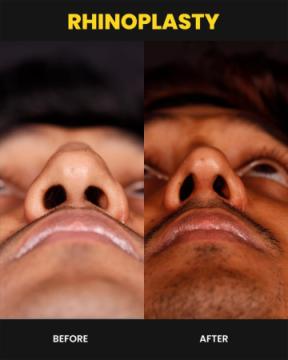 Cosmetic Surgeon in Kochi