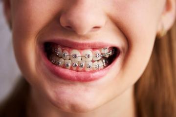 Wedding Smile Packages in Madurai