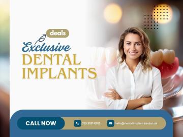 Grab offers and deals on tooth implants solution