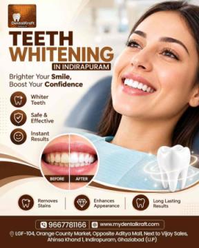 Teeth Whitening Treatment in Indirapuram for a Brighter Smile
