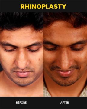 Cosmetic Surgeon in Kochi