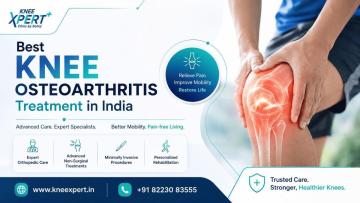 Best Knee Osteoarthritis Treatment in India – KneeXpert
