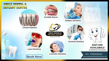 Top Dental Clinic in AS Rao Nagar, Sainikpuri | Smile Dental and Implant Centre
