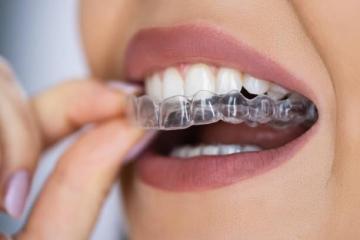 Raman Nazari, The Best Dental Doctor in San Jose