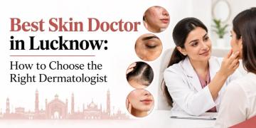 When Should You Visit a Skin Doctor in Lucknow?