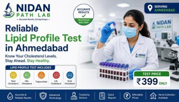 Book Lipid Profile Test in Ahmedabad at Nidan Path Lab