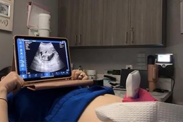 Albion X Ray and Ultrasound