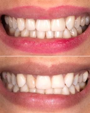 Zahnaerztin Muenchen Dr. Sabrina von Rakowski | Endodontie, Implantate, Zahnersatz |