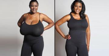 Plastic Surgeon Cape Town – Dr.Tjasink
