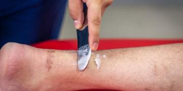 Effective Diabetic Foot Wound Treatment for Faster Healing