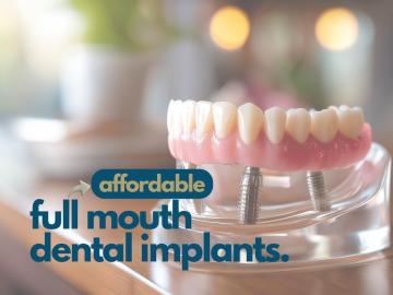Grab offers and deals on tooth implants solution