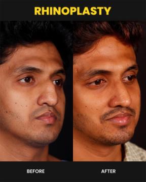 Cosmetic Surgeon in Kochi