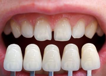 Dentist Vastrapur