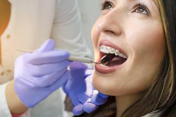 Dental cleaning Fort Worth