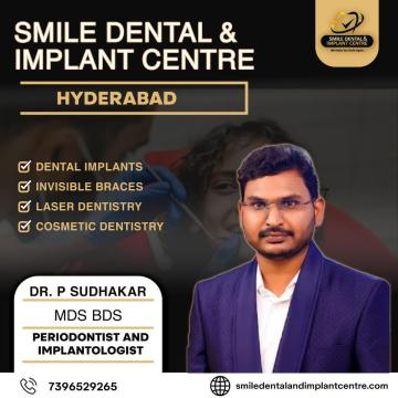 Most Trusted Dentist Near AS Rao Nagar, Secunderabad | Smile Dental and Implant Centre