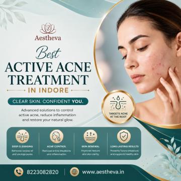 Best Active Acne Treatment in Indore - Aestheva